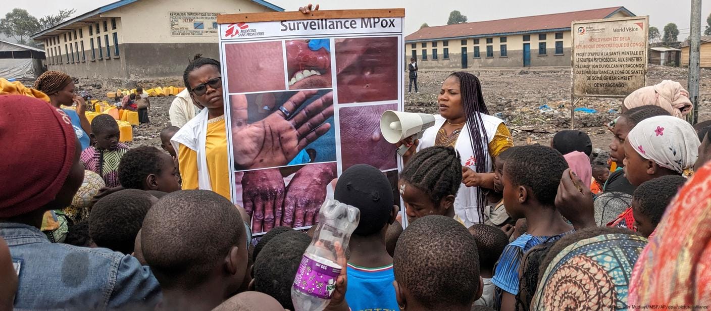 Medical teams in Congo are racing against the clock to try and contain the MPox outbreak | W.H.O Declares Mpox a Global Health Emergency | Mania Health